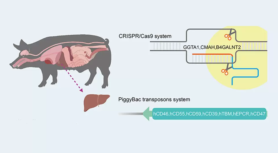 Прорыв в ксенотрансплантации: свиная печень у живого пациента с опухолью